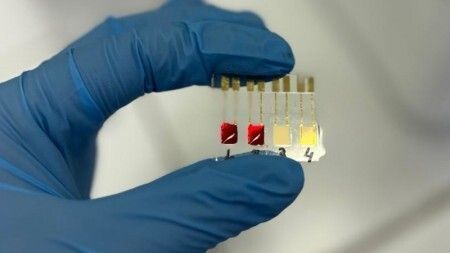 USP cria biossensor barato que identifica câncer de pâncreas rapidamente