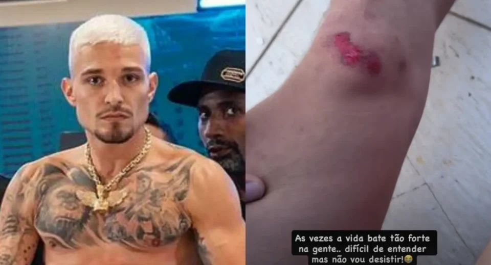 Após incêndio na casa dos pais, MC Gui se machuca em moto