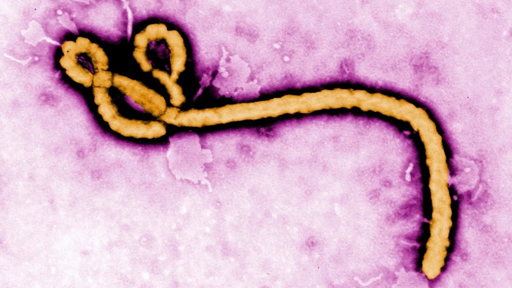 Paciente com suspeita de Ebola é internado e recebe cuidados