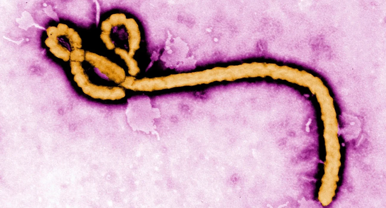 Paciente com suspeita de Ebola é internado e recebe cuidados