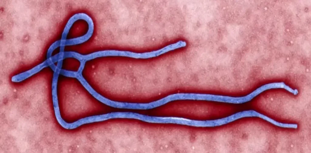 Caso suspeito de ebola é descartado em paciente no RS com segurança