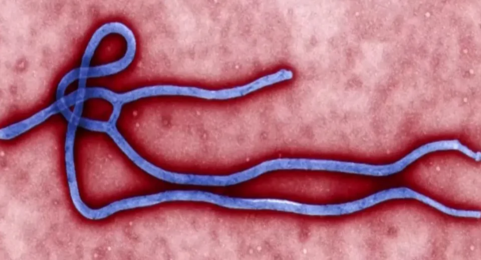 Caso suspeito de ebola é descartado em paciente no RS com segurança