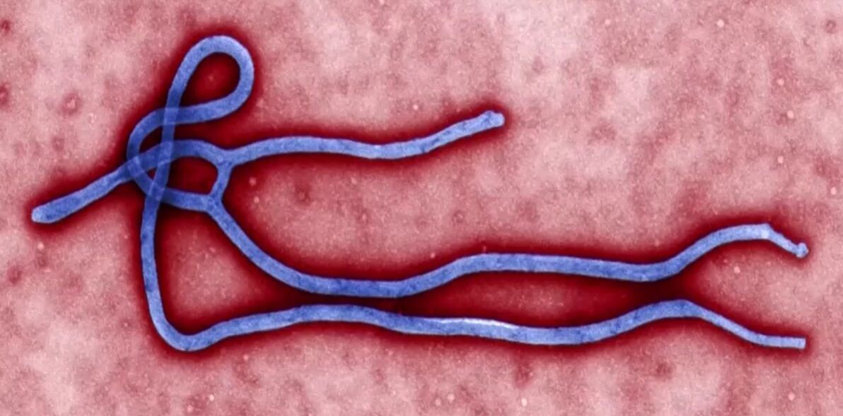 Caso suspeito de ebola é descartado em paciente no RS com segurança