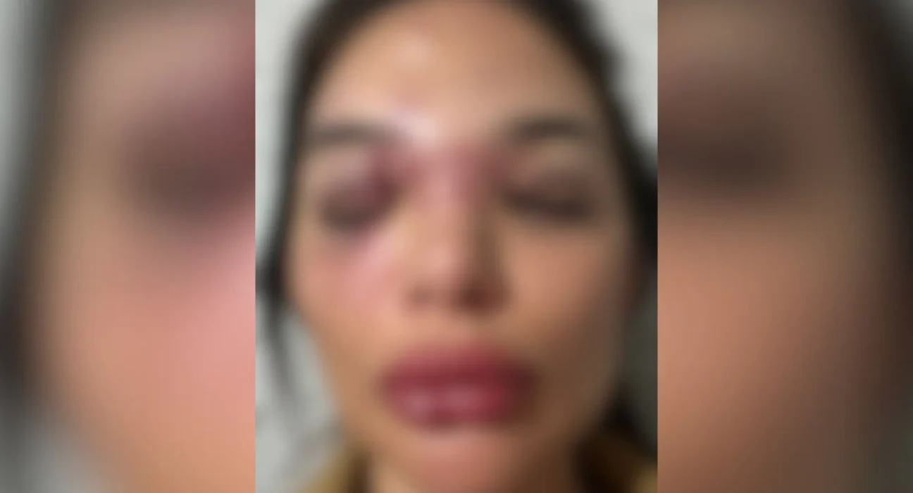Depoimento de mulher agredida por empresário em São Paulo: Impacto e Superação