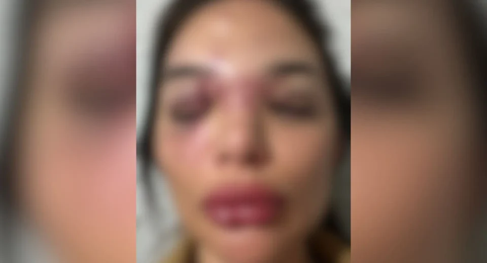 Depoimento de mulher agredida por empresário em São Paulo: Impacto e Superação